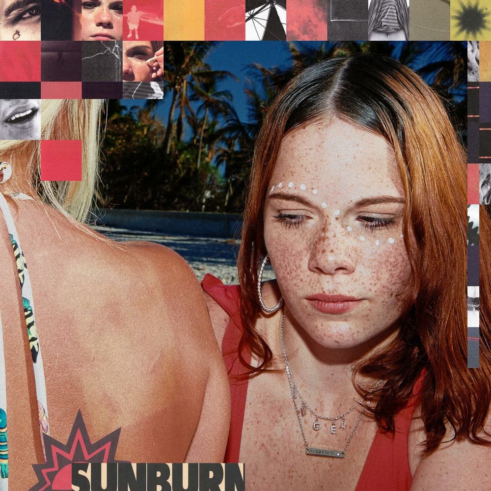 Sunburn cover
