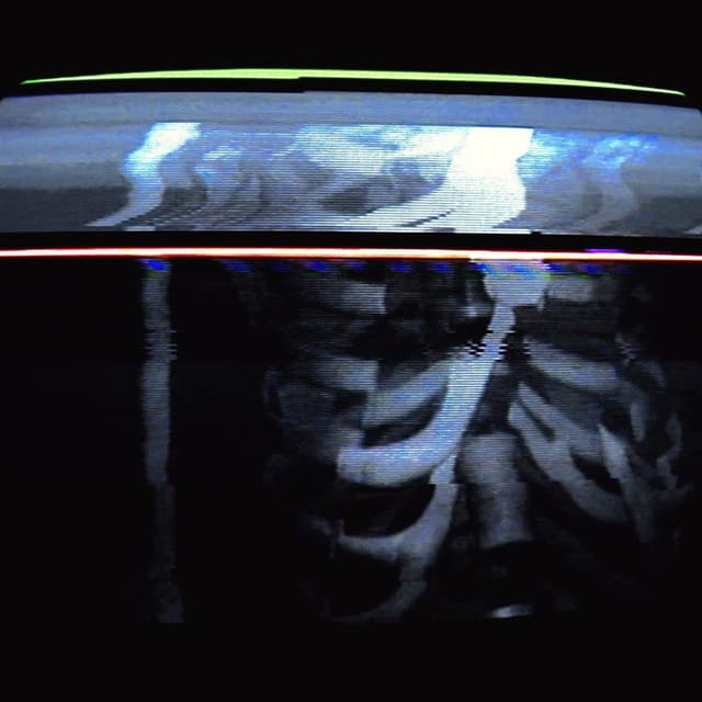 CARCASS cover