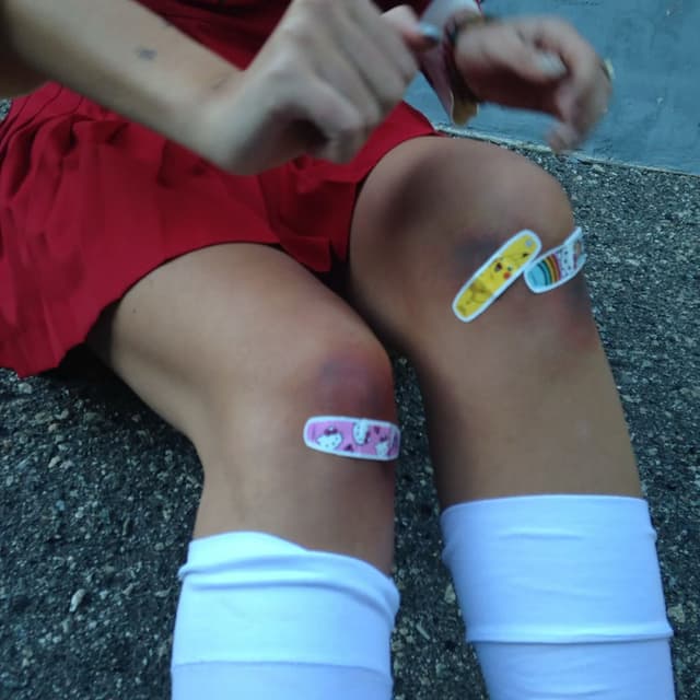 Bruise cover